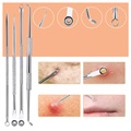 Blackhead Remover Needle Tool Set - 10 Pcs.